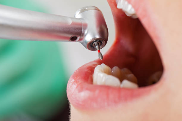 Best Root Canal Emergency Dentist  in Chesterton, IN